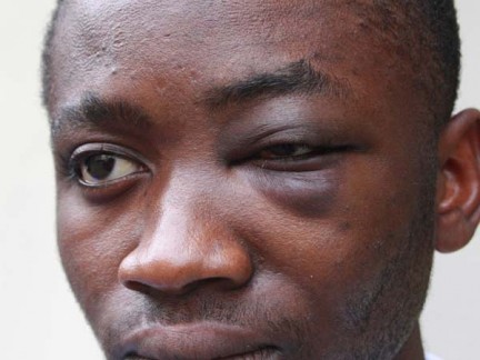 Dieci anni fa il pestaggio di Emmanuel Bonsu